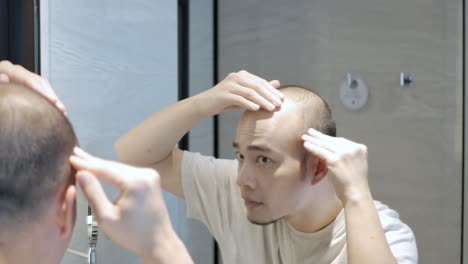 pov to a yong asian man concerns about the hair on his head from mirror, bald spots suffering from hair loss