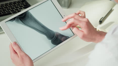 Veterinarian examining a horse's foot X-ray on a tablet