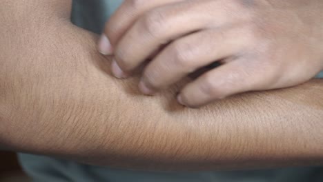 persona con picazón en el brazo