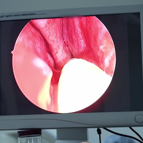 doctor processing surgical operation