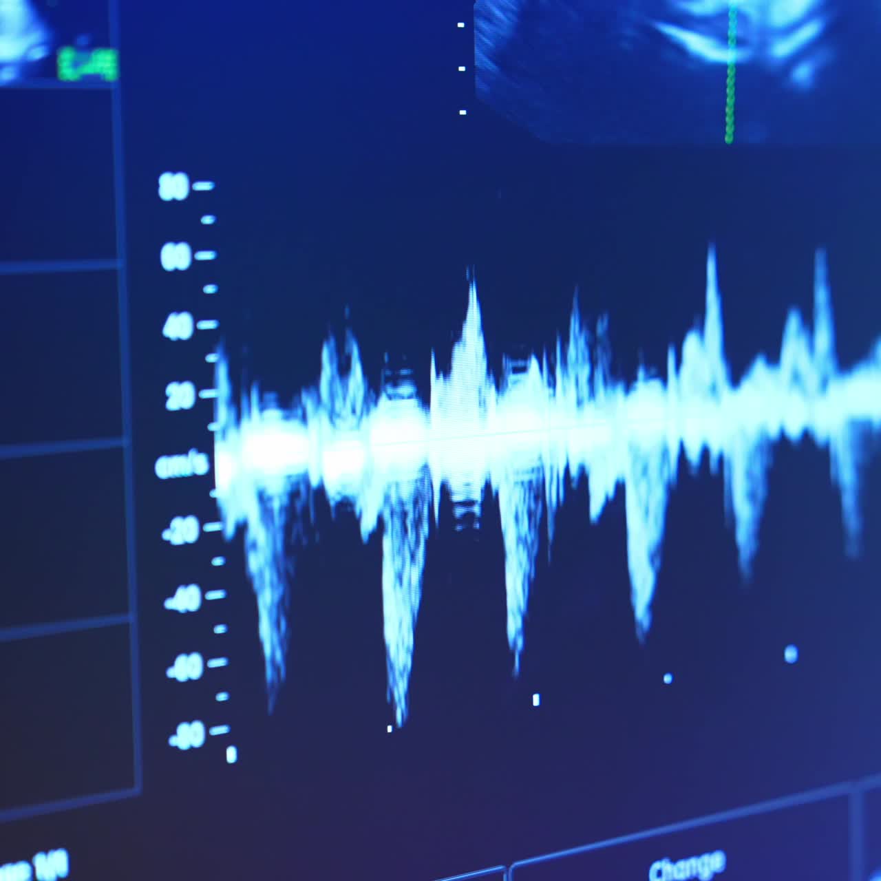 Blue screen at ultrasound diagnostic equipment. White curve moving quickly on the monitor and the shot of a baby inside mom's belly
