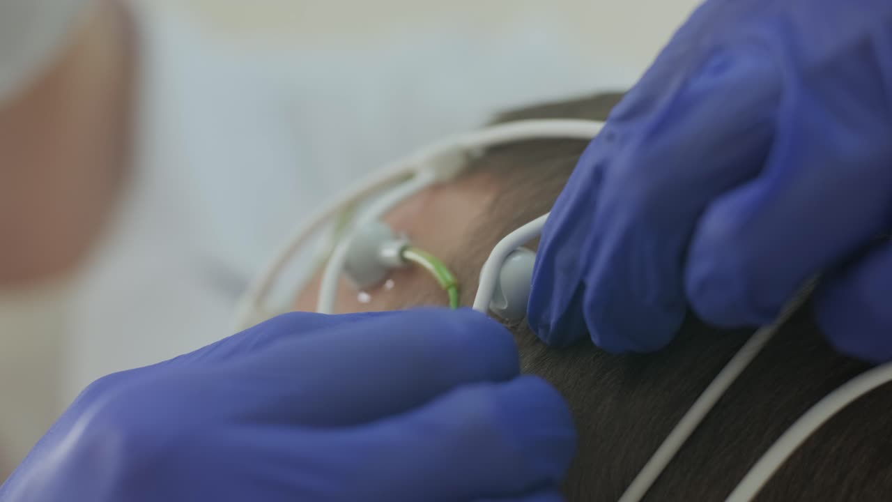 Test del cervello del paziente utilizzando l'encefalografia in un centro medico