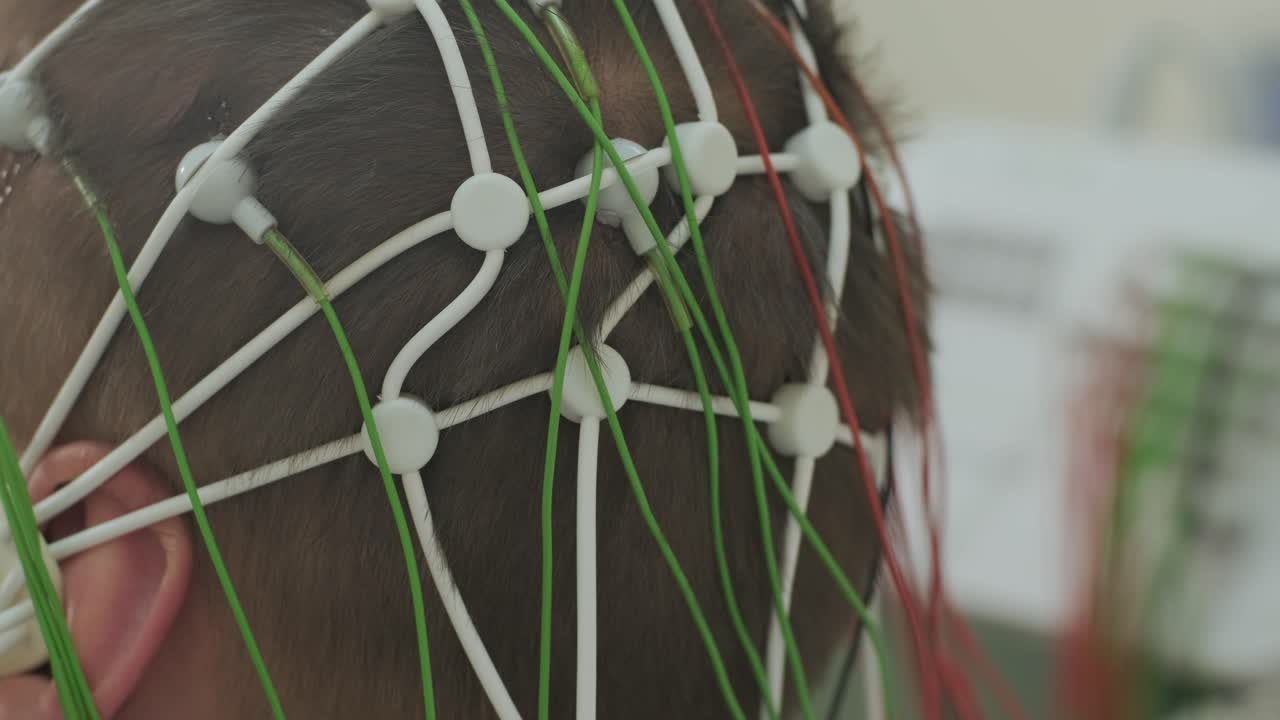 pruebas cerebrales del paciente utilizando la encefalografía en el centro médico