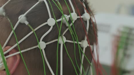 Patient brain testing using encephalography at medical center