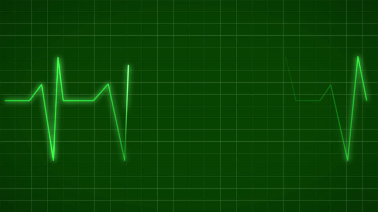 Tracciato elettrocardiografico (ECG)