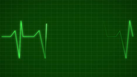 seguimiento del electrocardiograma (ecg)