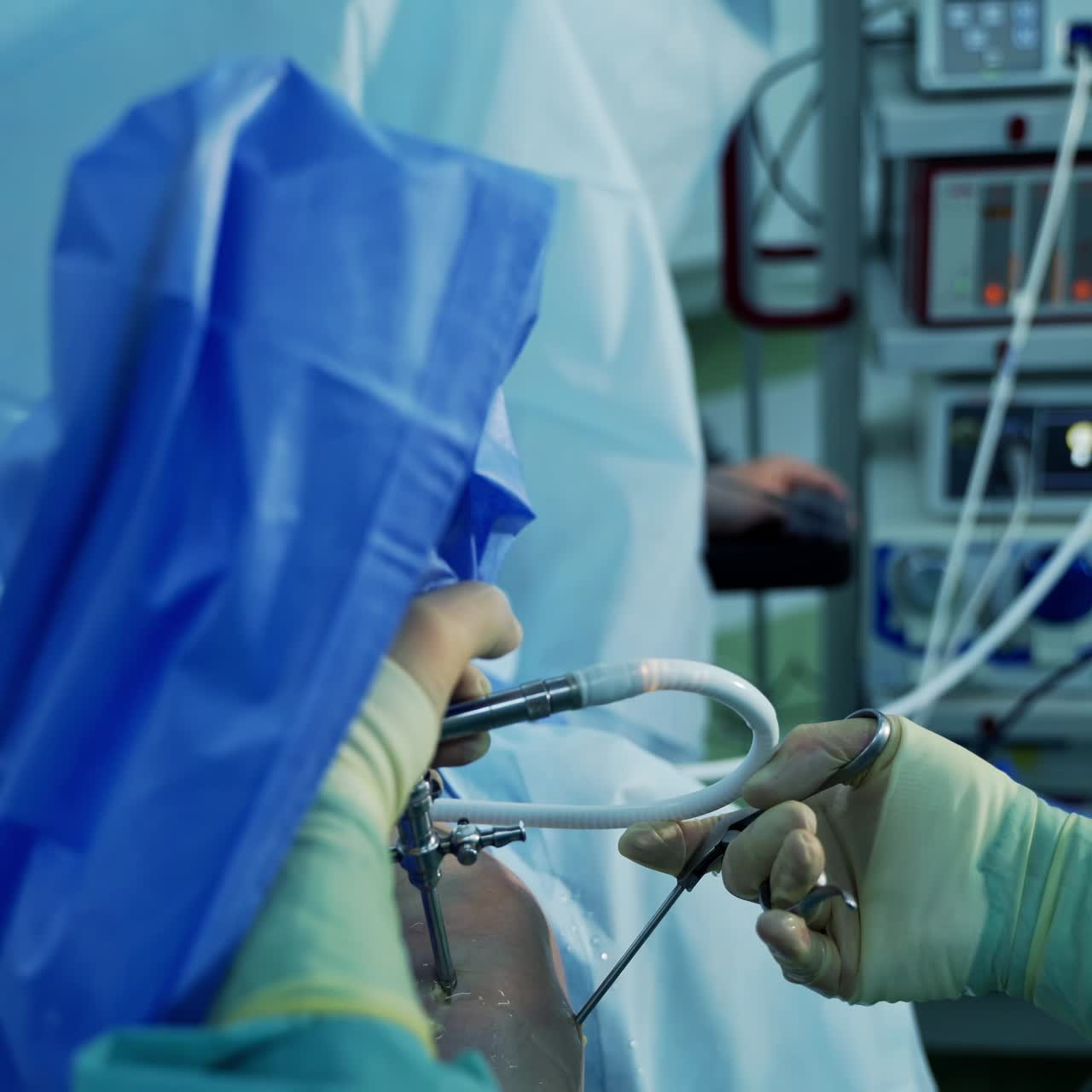 Modern surgery equipment in hospital. Team of professional surgeons working about operation