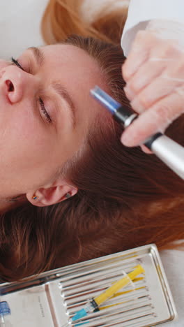 Tricólogo-Realizando-Procedimientos-De-Regeneración-Del-Cabello-Femenino,-Microagujas-Dermapen,-Inyecciones-De-Vitaminas