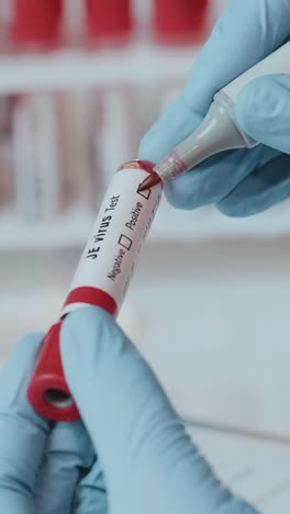 healthcare professional analyzing blood test tube for je virus in clinic