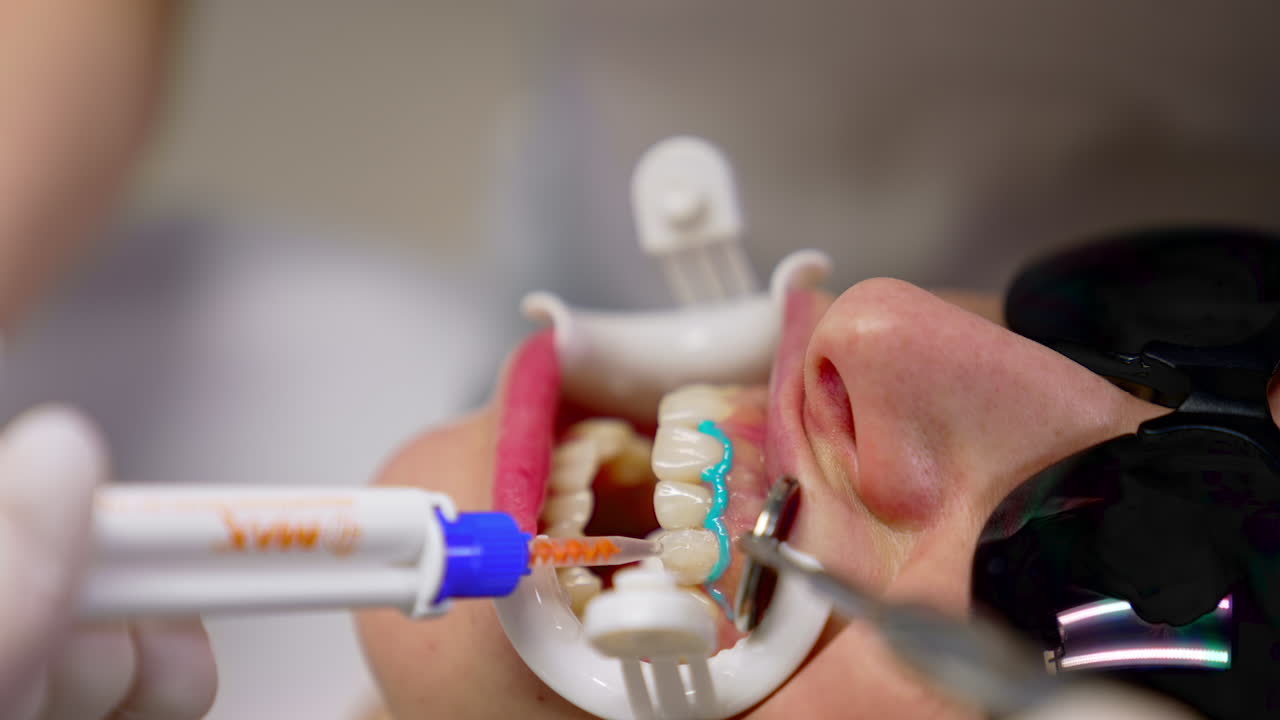 Modern dental process on female's teeth. Face of a woman in black glasses with opened mouth during stomatology procedure on her teeth with medical tools. Close-up.