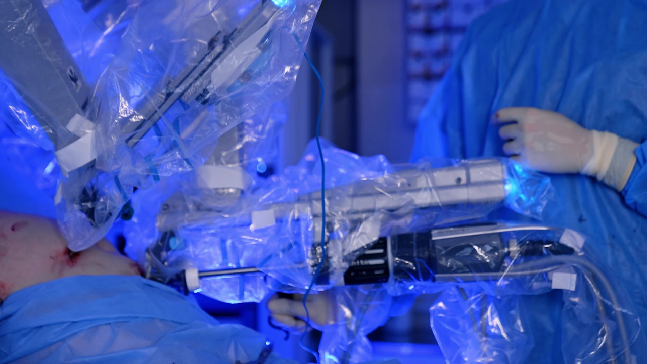 Technological robotic surgeon operating the patient. Manipulator arms covered in plastic move slowly performing laparoscopic surgery. Unrecognized doctor cropped image at backdrop.