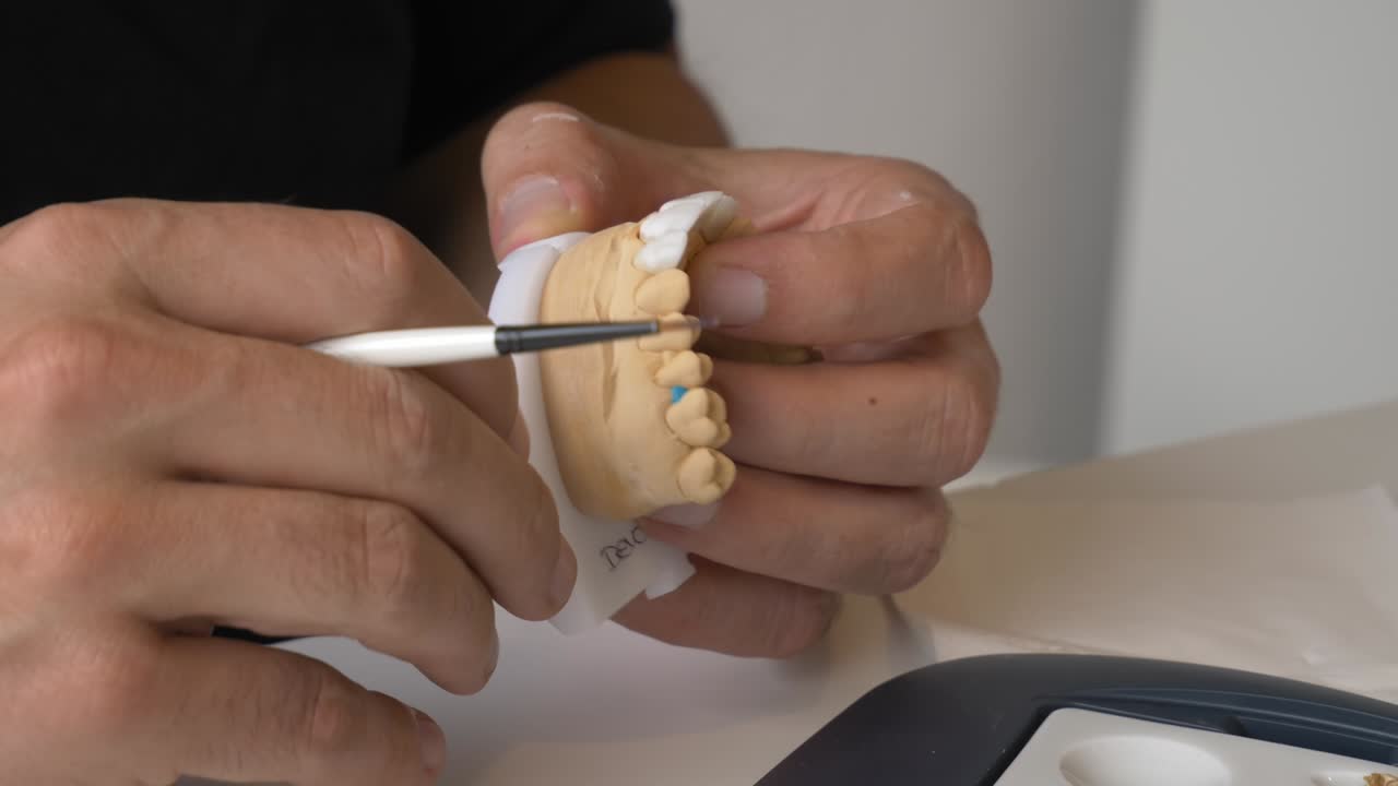 Detailed dental prosthesis preparation using precision tools in close up