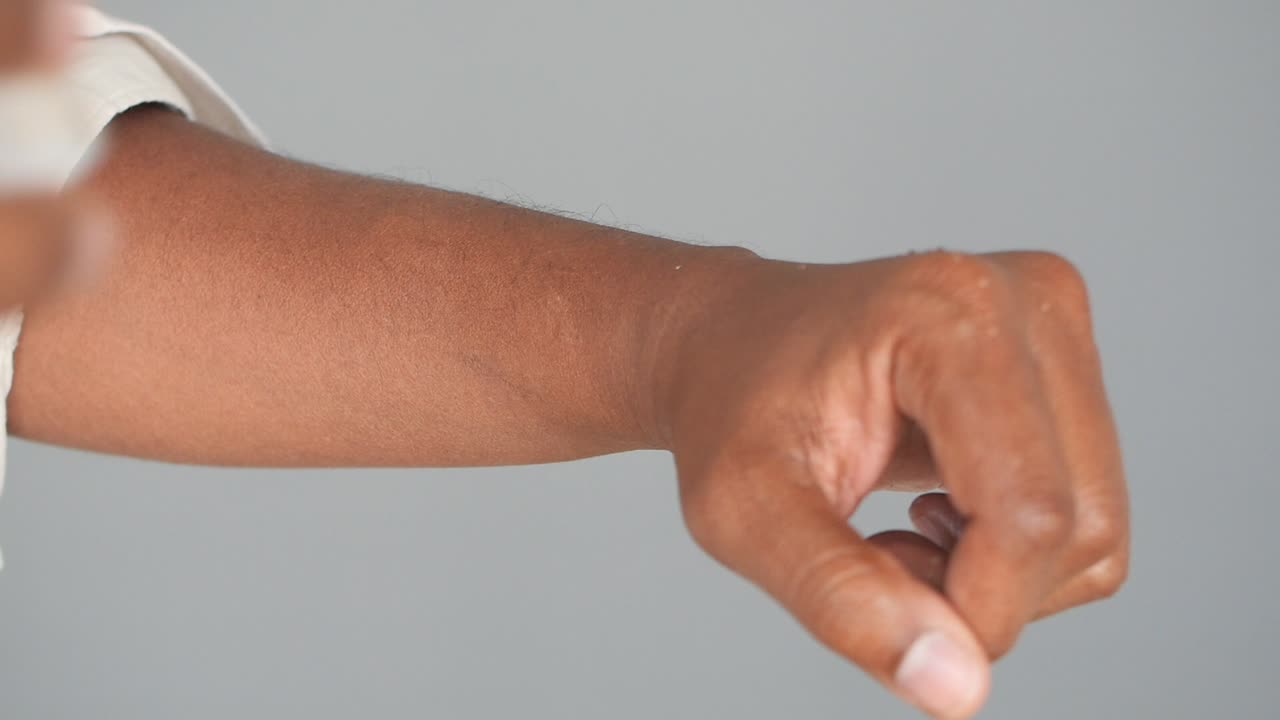 Applying ice and cream to an injury