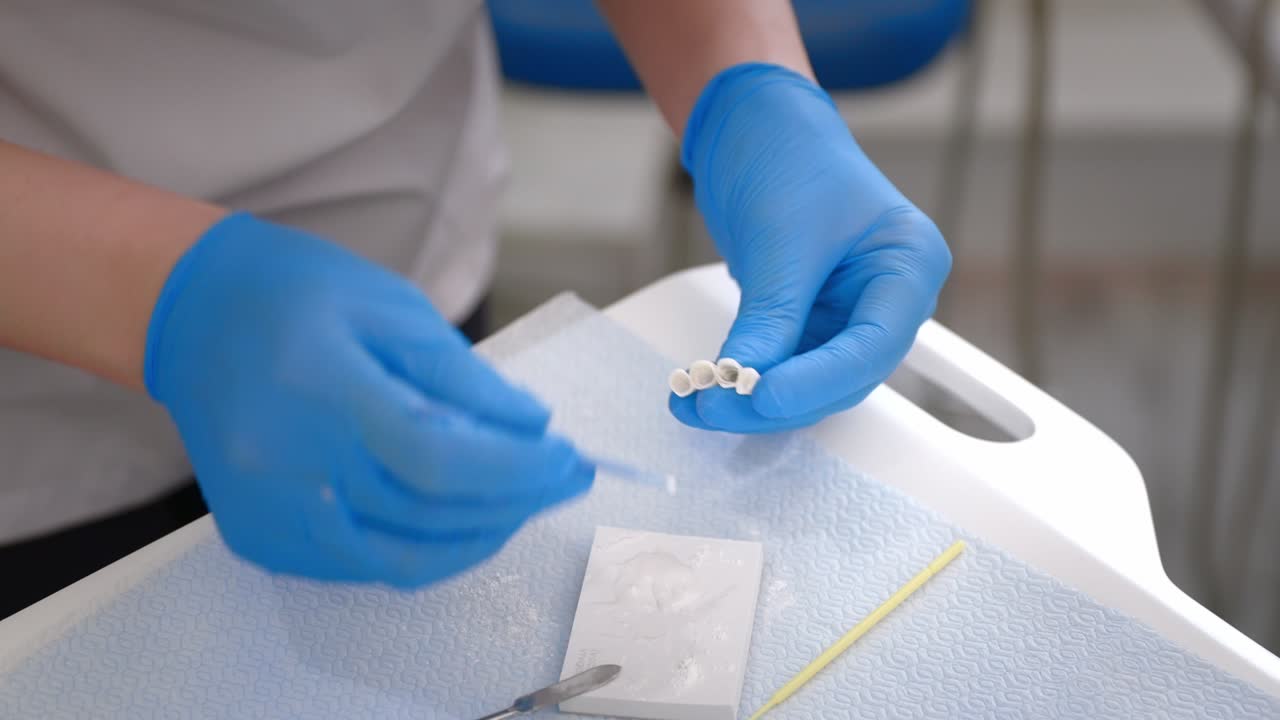 manos de un dentista con guantes médicos trabajando con implantes dentales y coronas en un consultorio médico