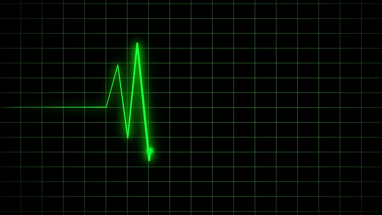 Linea verde del battito cardiaco su monitor EKG su sfondo a griglia