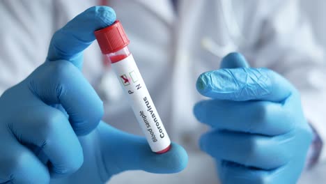 muestra de sangre de coronavirus
