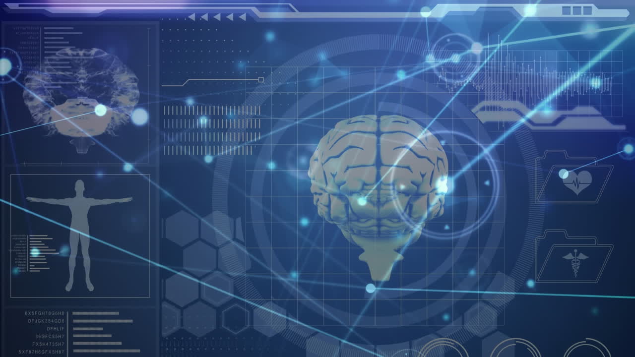 Animation of network of connections with human brain and medical data processing