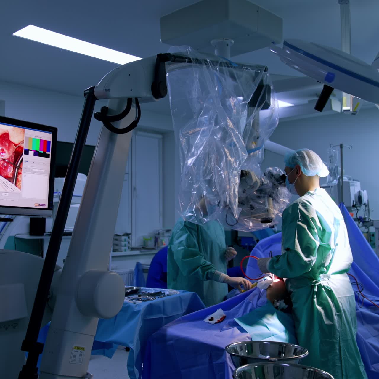 Surgeon stands at the innovative microscope looking at the operated area through it. Screen shows the incision and performed surgery