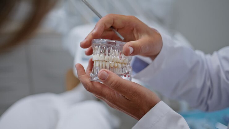 Primo piano di mani di dentista che tengono un modello dentale in una clinica stomatologica. Donna sconosciuta