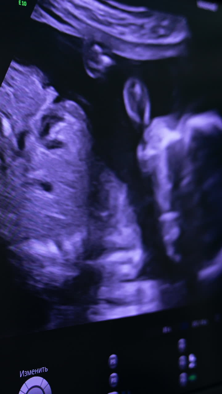 Image of a baby moving in the mom's womb. Monitor of ultrasound machine close up. Vertical video