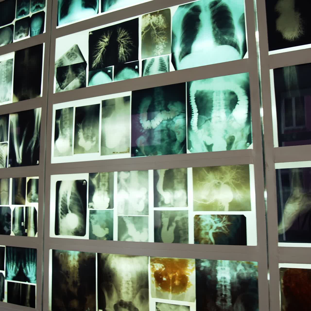 Wall with multiple MRI photos. Many x-ray photographs showing people's bones. MRI images including: head, neck, arm, foot, pelvis