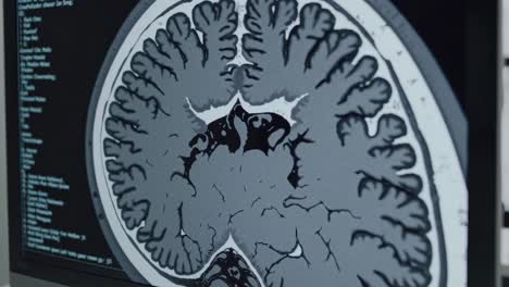 brain mri/ct scan image