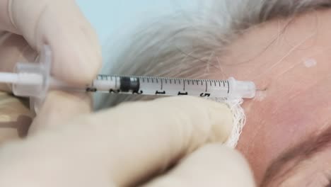 an older person receives an injection shot of botox into the forehead to reduce wrinkles