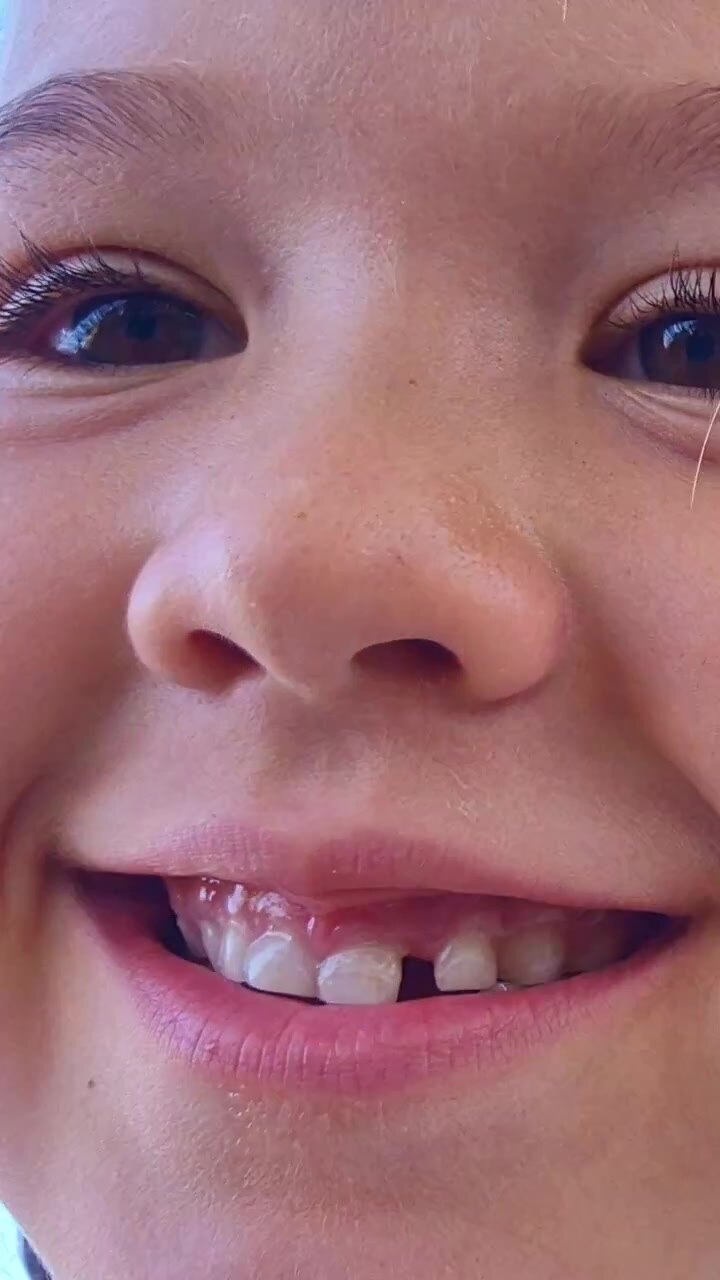 Close up of a happy girl smiling with missing baby teeth