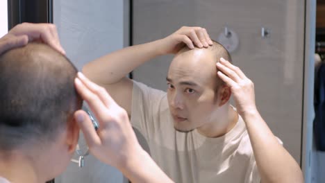 punto de vista de un joven asiático preocupado por el cabello en su cabeza del espejo, calvas que sufren de pérdida de cabello