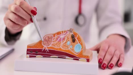 doctor explaining breast anatomy and potential conditions using a medical model