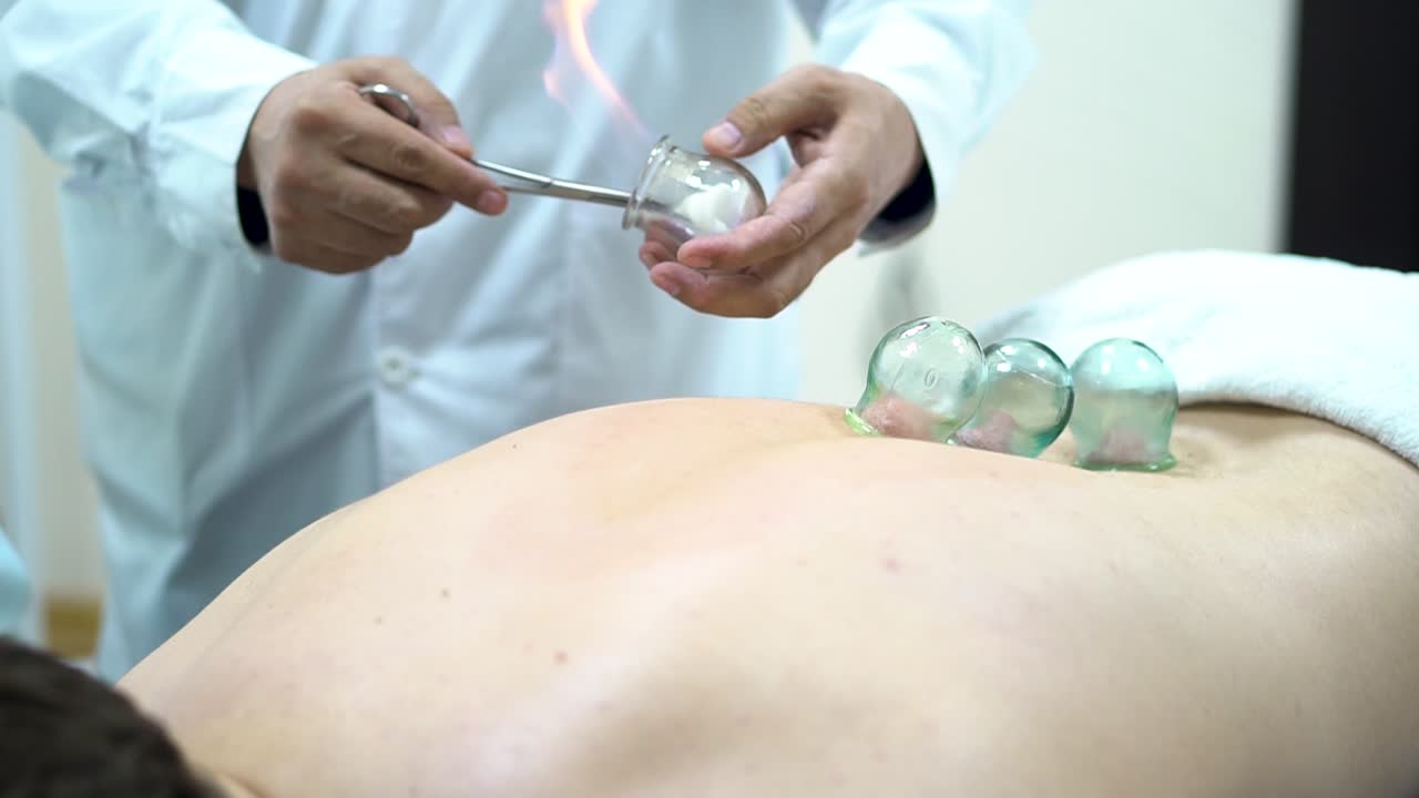 sesión de terapia de ventosas