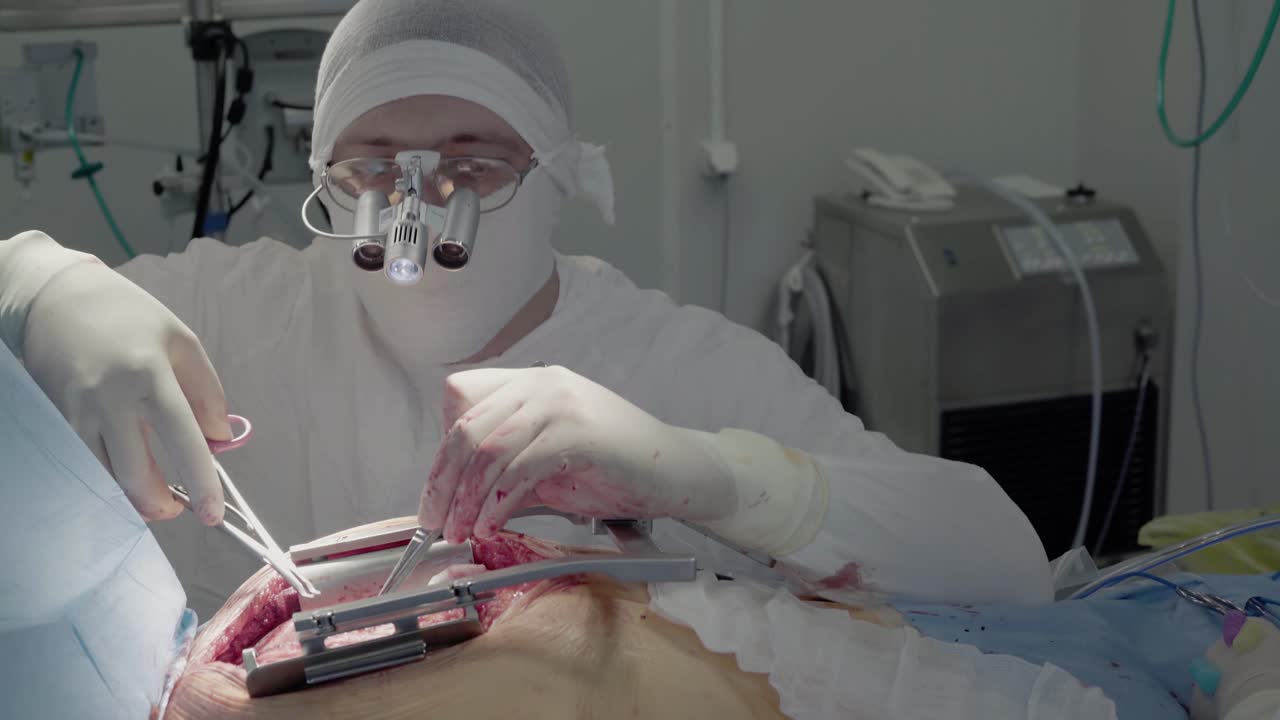 심장 외과 의사 는 간호사 의 도움 으로 심장 수술 을 수행 한다