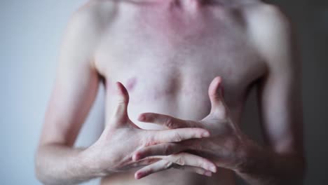 transgender man showing surgery scars on chest