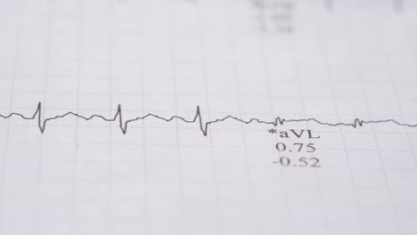 electrocardiogram (ecg) readings