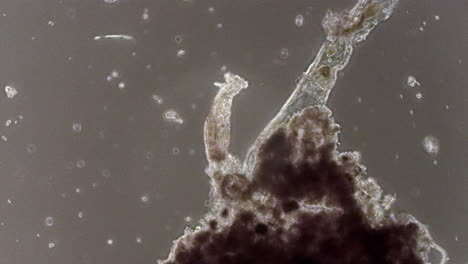 un filtro de rotífero microscópico alimenta y retrae su cuerpo