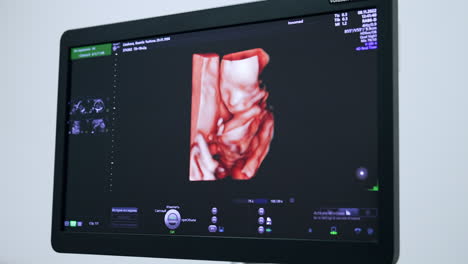3d image of an unborn baby on the monitor of ultrasound machine. pregnancy check up.