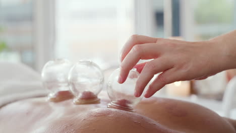 una massaggiatrice che usa la terapia delle coppette per rilasciare indietro