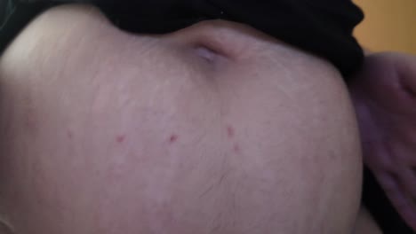 belly fat of overweight person in slow motion. close up