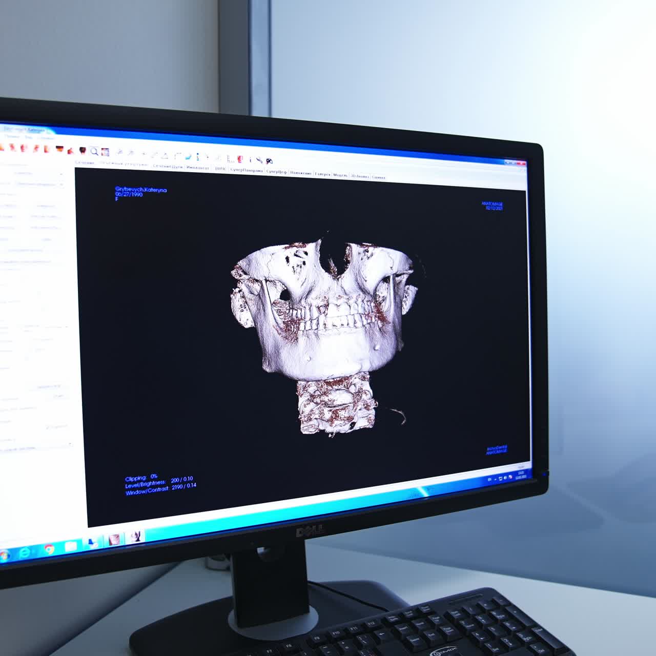 Modern stomatology xray scanner. X-ray teeth dentistry scanning