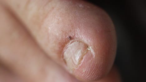 ugly man toes, close up of foot finger nails