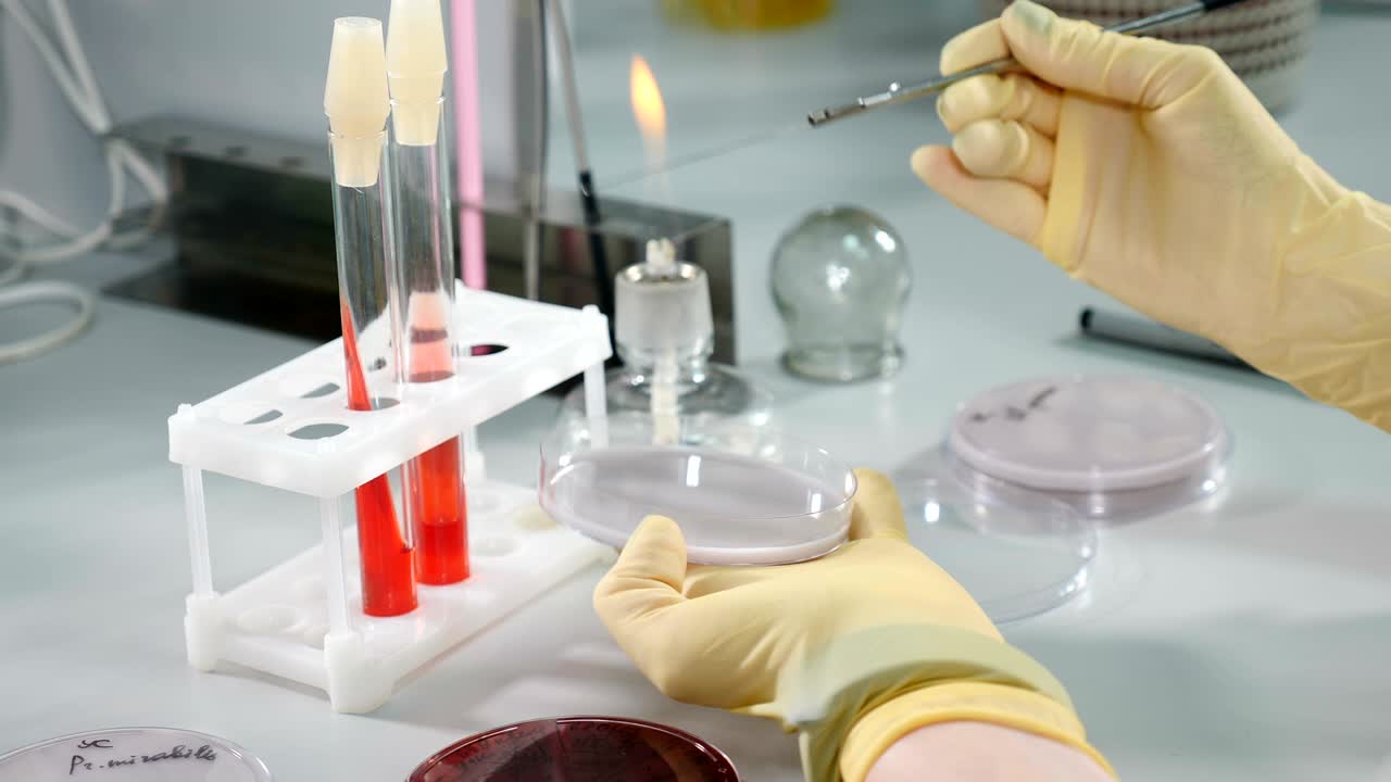 trabajo de laboratorio microbiológico en una placa de petri. microbiólogo de primer plano con bucle bacteriano recoge el cultivo de bacterias de la placa de petri para el análisis. científico recoge el cultura de bacterias utilizando bucle microbiológico. video 4k