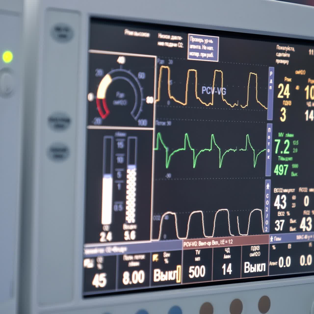 Monitors in intensive care unit. Heart beat of a patient on the screen of computers during operation in the hospital. Healthcare concept