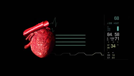 Video-of-an-electrocardiogram