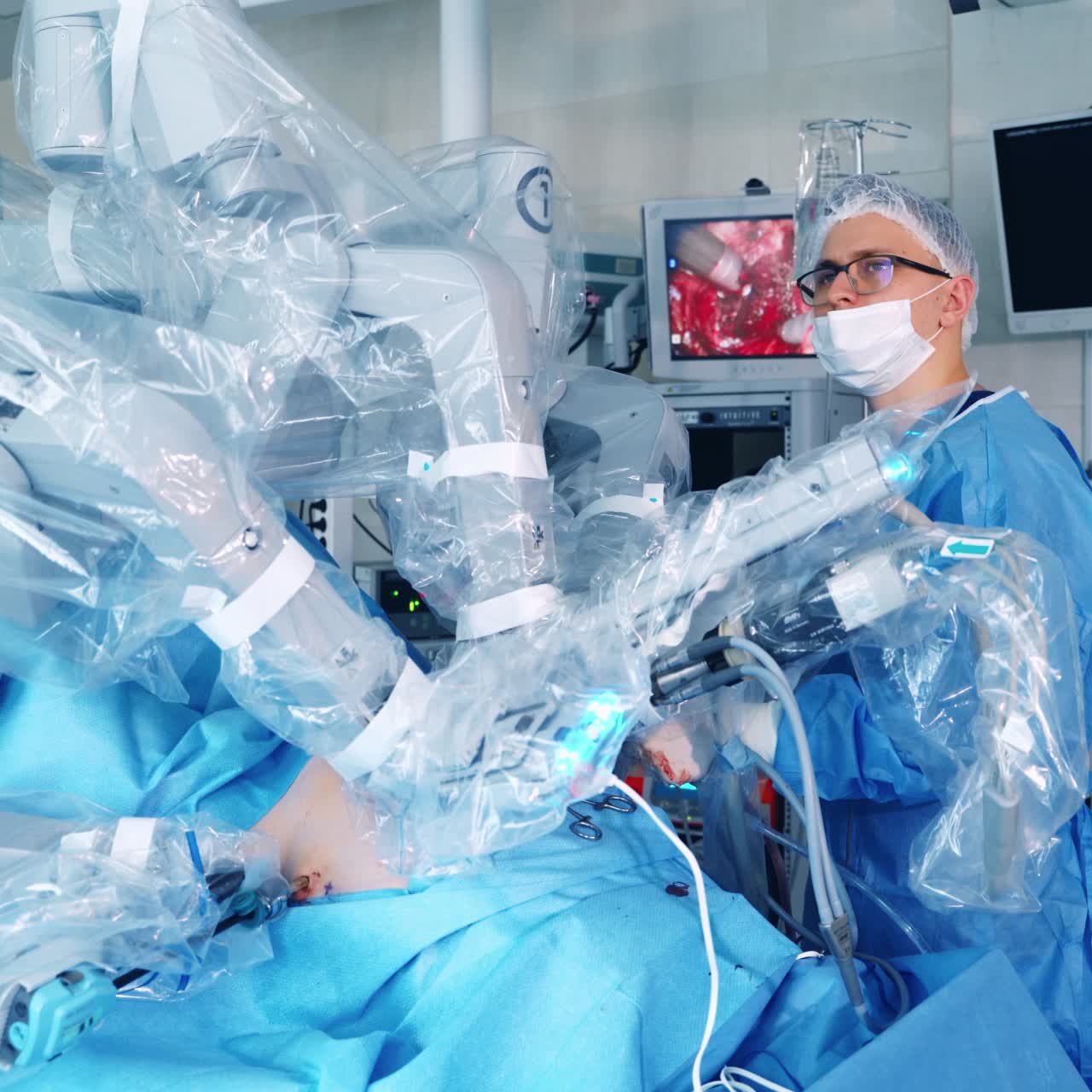 Modern surgical robot in clinic. Doctors perform minimally invasive surgery using a robotic device. Surgeons look at the screen of a monitor.