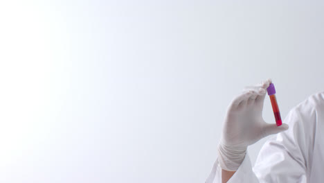 hand wearing medical glove holding blood sample on white background with copy space, slow motion