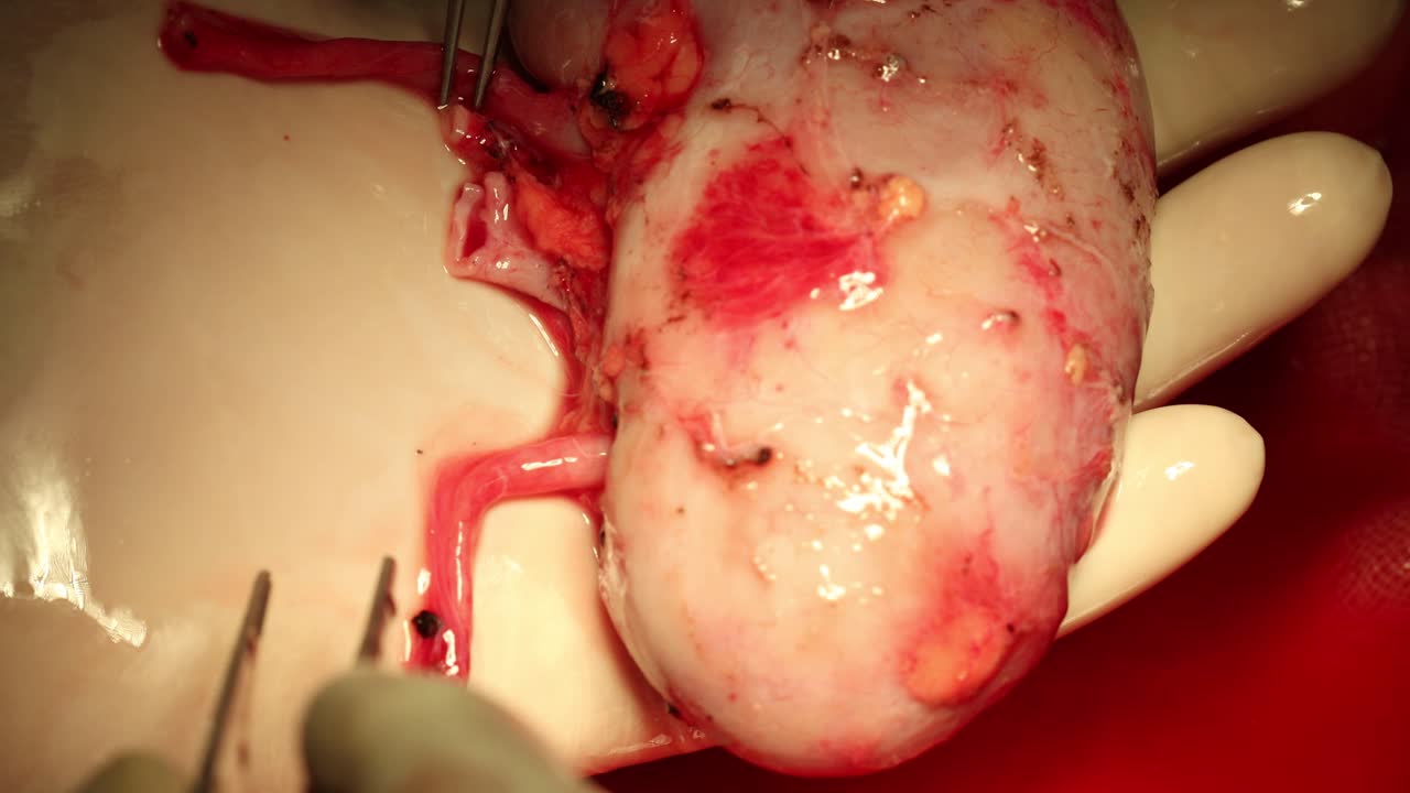 riñón para el trasplante de órganos