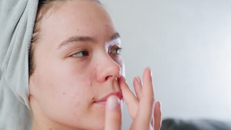 portrait view of young woman with visible pimples gently massaging cheek with fingers while applying skincare cream, towel wrapped around head, practicing personal care, facial treatment