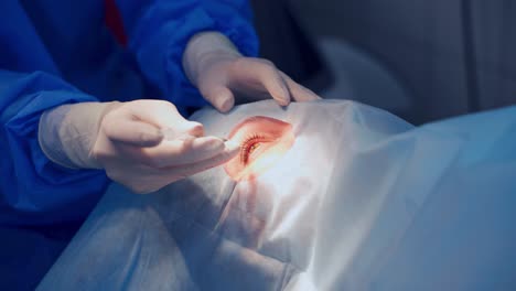 patient under sterile cover. close up detail of a surgery of the eye