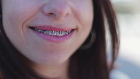 toothy smile of young girl with braces