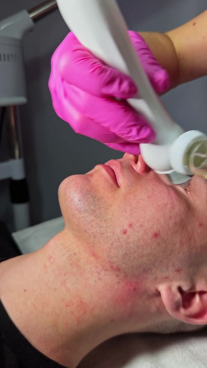 Sesión de tratamiento cutáneo en una clínica con enfoque en el cuidado facial y de la piel, mientras el cliente se relaja bajo atención profesional